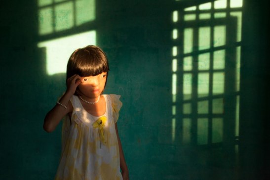 A young Vietnamese woman whose mother was exposed to Agent Orange. Photo (c) Ed Kashi/VII Photo